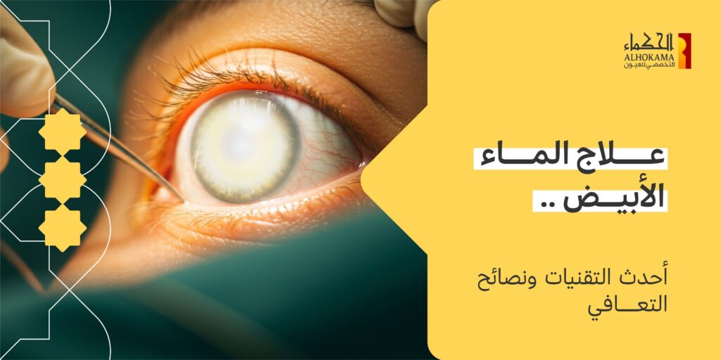 الماء الأبيض