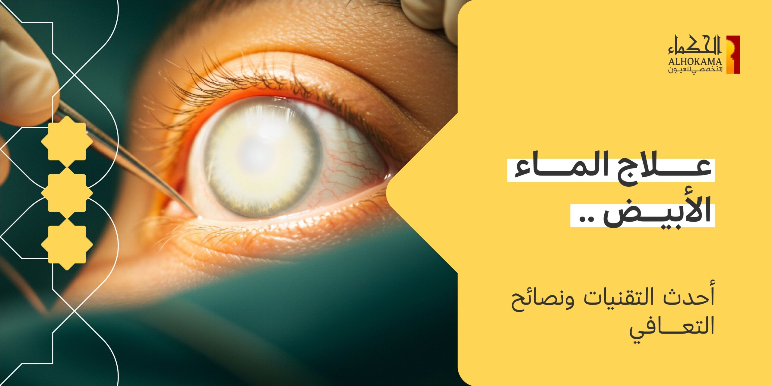 الماء الأبيض