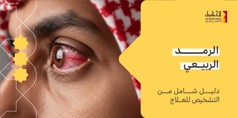 الرمد الربيعي