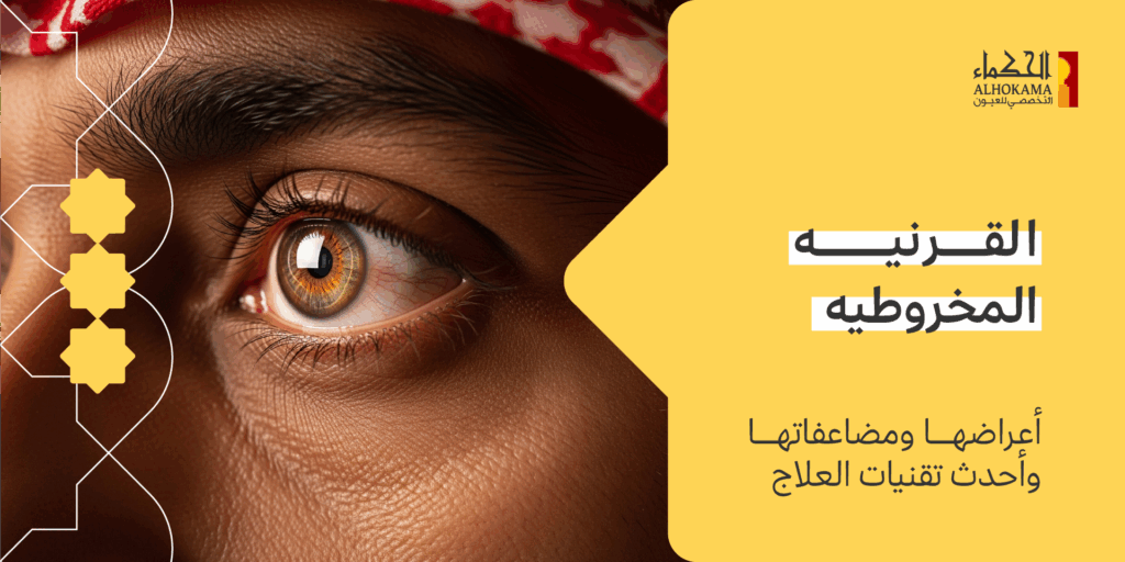 القرنيه المخروطيه