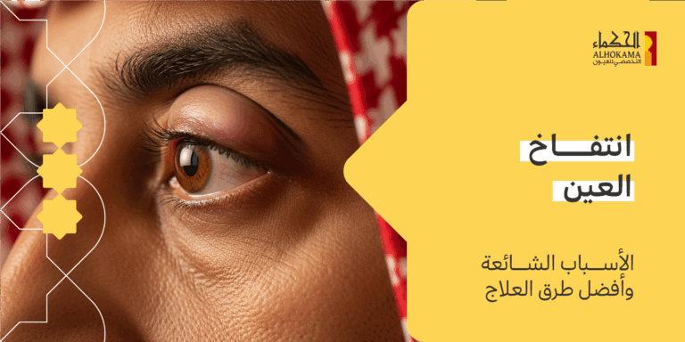 انتفاخ العين