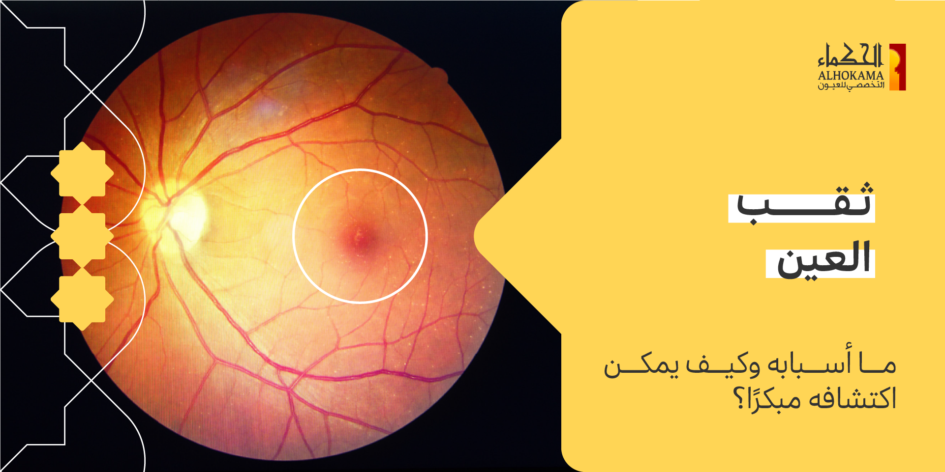 ثقب العين