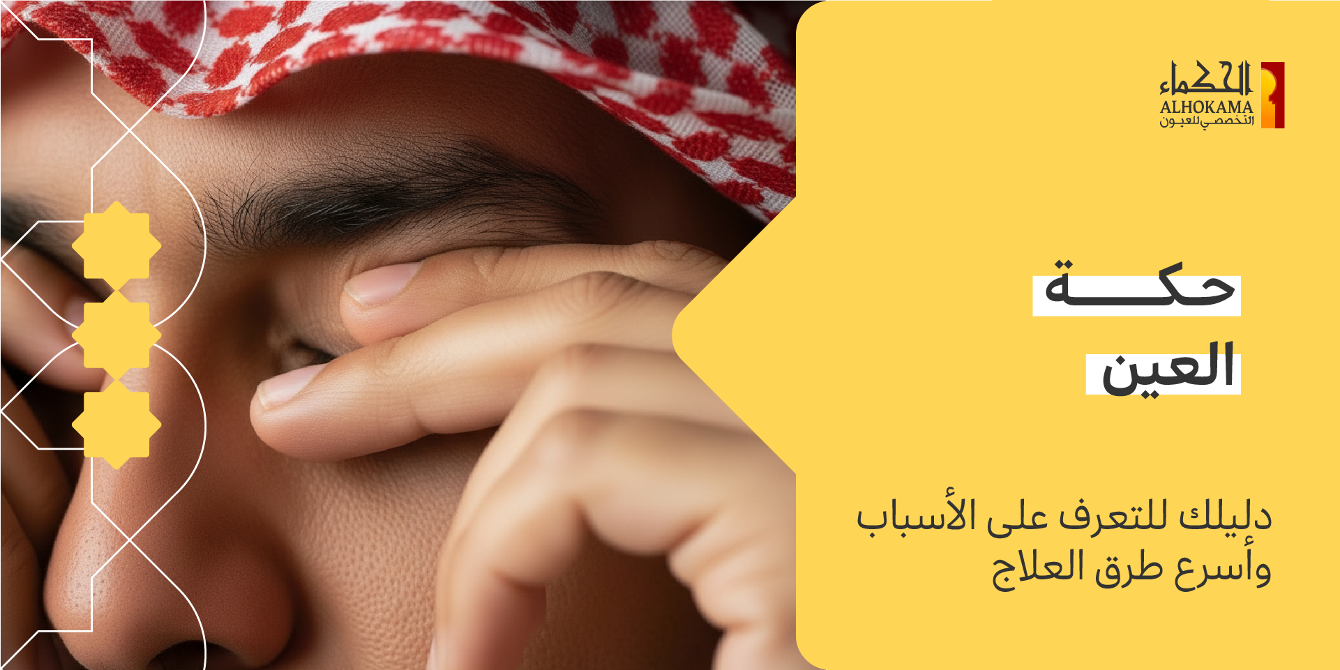 حكة العين