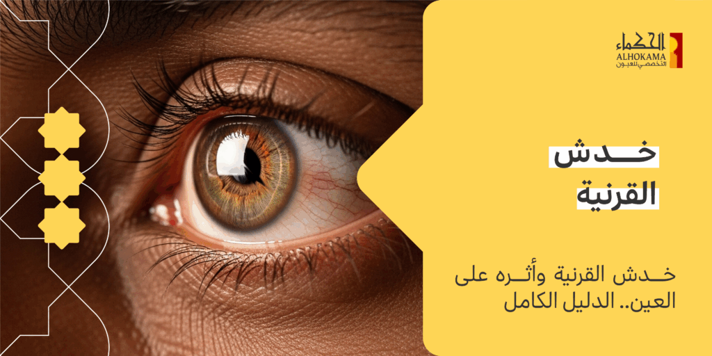 خدش القرنية