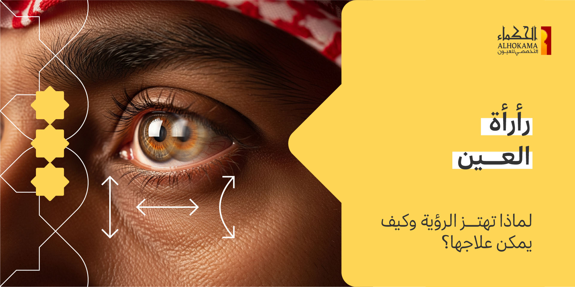 رأرأة العين