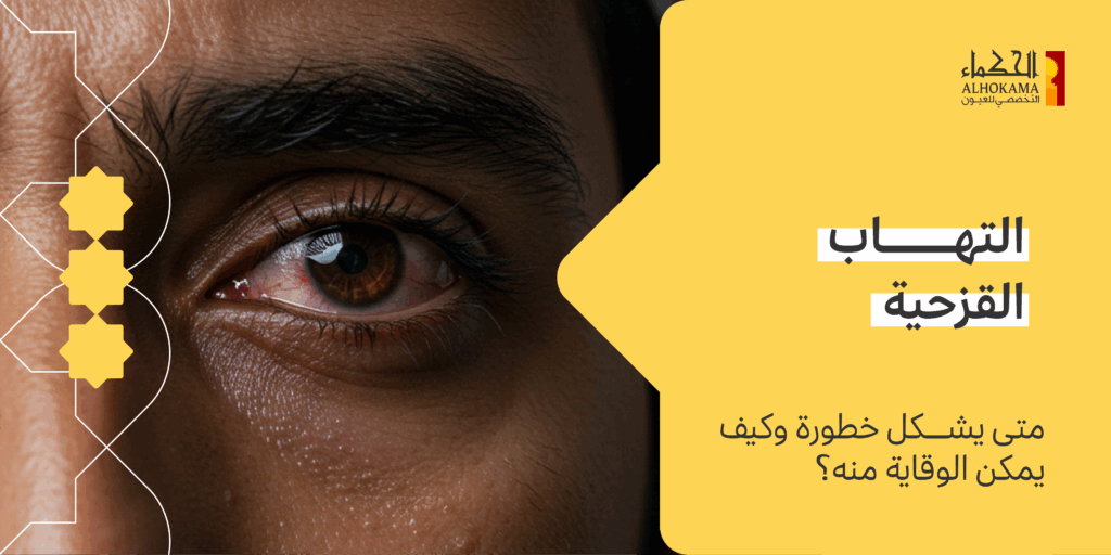 التهاب القزحية