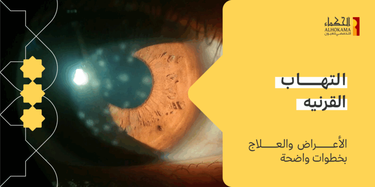 التهاب القرنيه