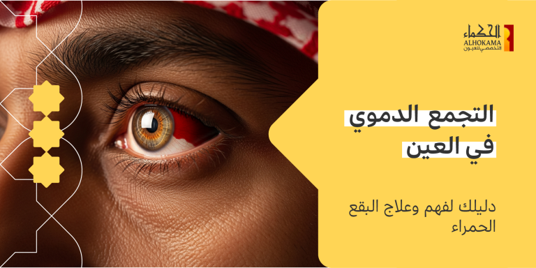 التجمع الدموي في العين