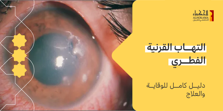 التهاب القرنية الفطري