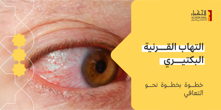التهاب القرنية البكتيري