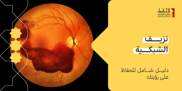 نزيف الشبكية