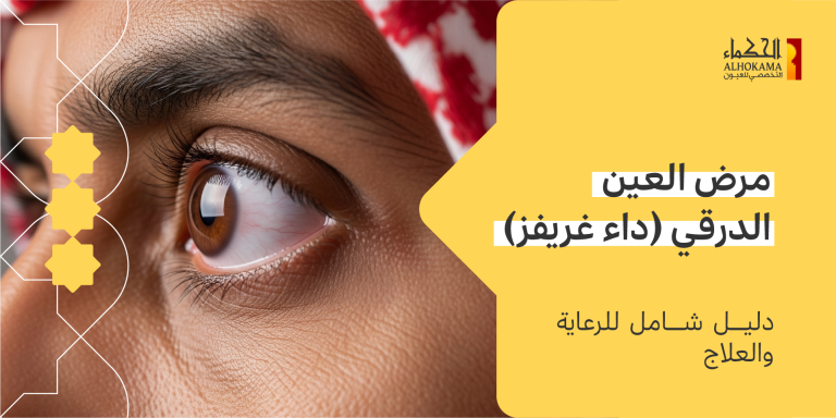 مرض العين الدرقي