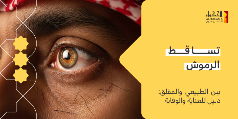 تساقط الرموش