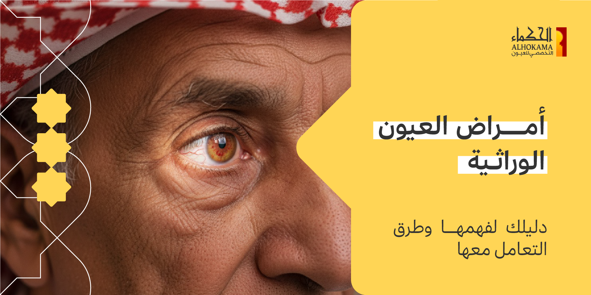 أمراض العيون الوراثية