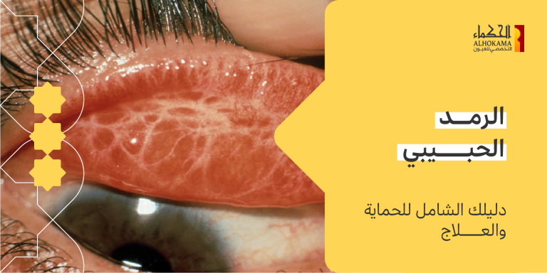 الرمد الحبيبي