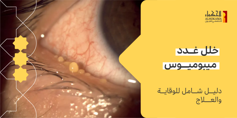 غدد ميبوميوس