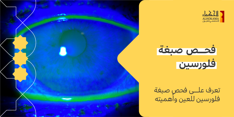 صبغة فلورسين للعين