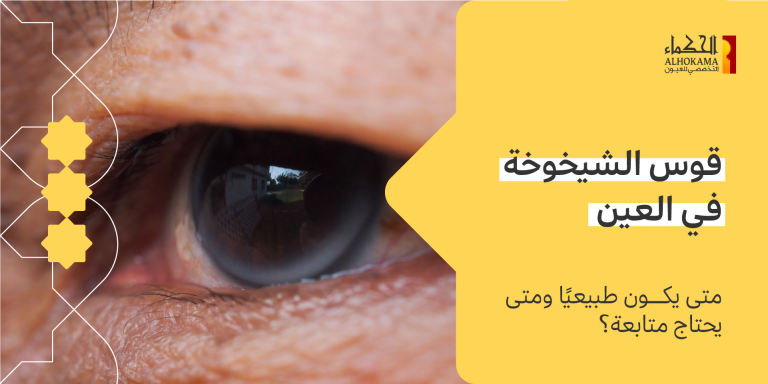 قوس الشيخوخة