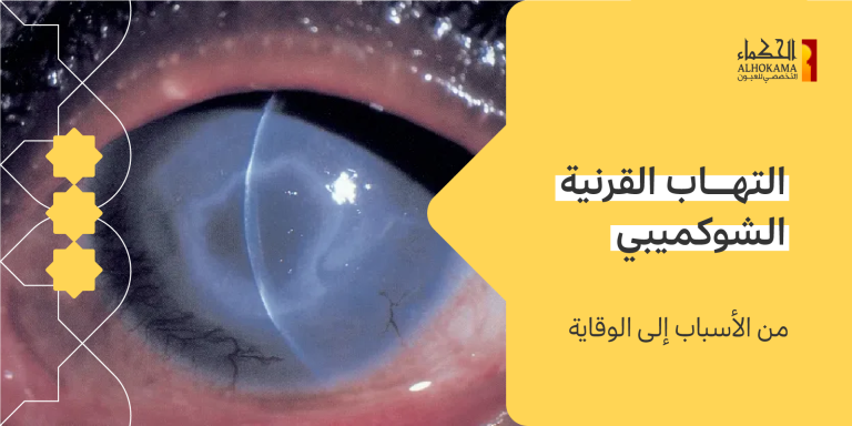 التهاب القرنية الشوكميبي