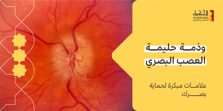 حليمة العصب البصري