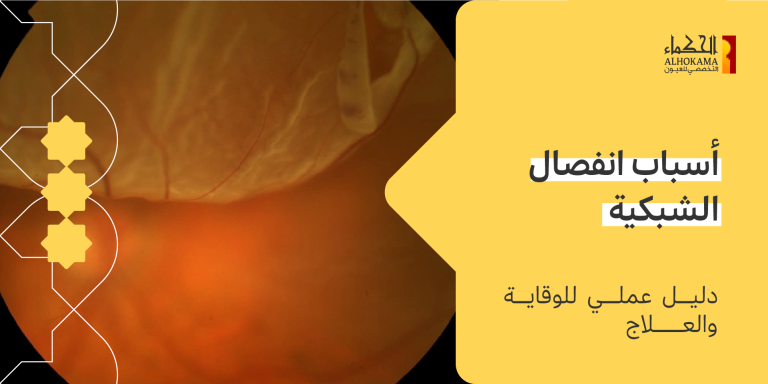 انفصال الشبكية