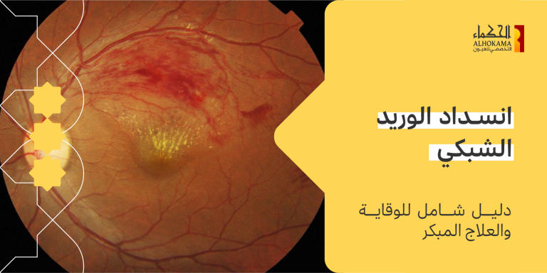 انسداد الوريد الشبكي