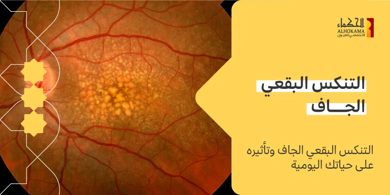 التنكس البقعي الجاف