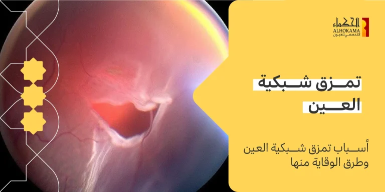تمزق شبكية العين