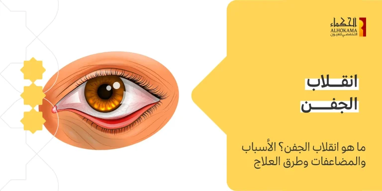 انقلاب الجفن