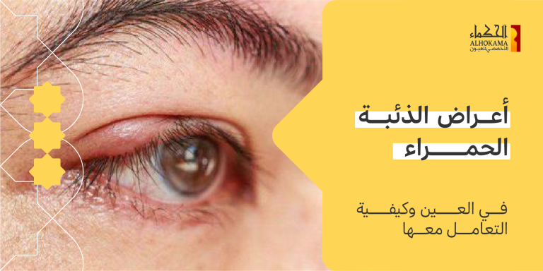 أعراض الذئبة الحمراء في العين