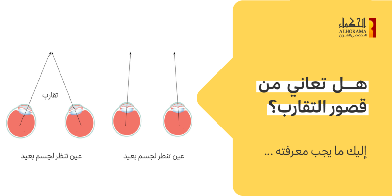 قصور التقارب