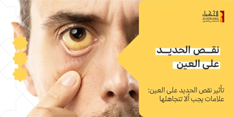 نقص الحديد على العين