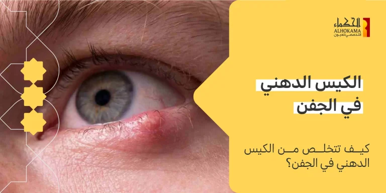 الكيس الدهني في الجفن