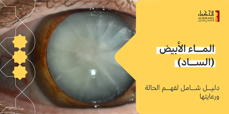 الماء الابيض